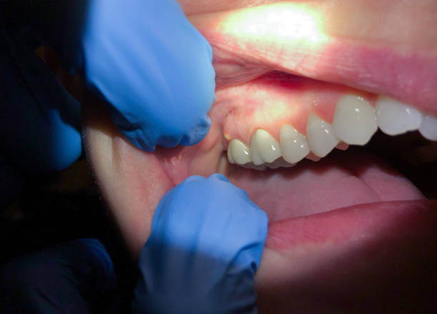 Best Emergency Dentist for Knocked-Out Tooth in Lemont Furnace, PA